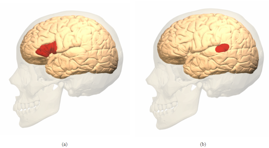 Broca's area in the left frontal lobe and Wernicke's area in the left temporal lobe.